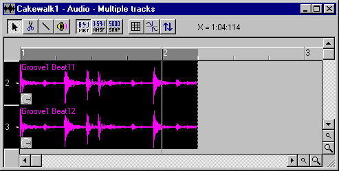 Audio view